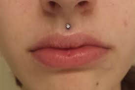 cicatrici da piercing